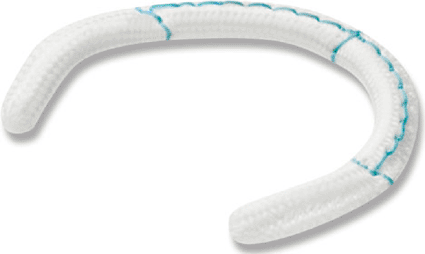 Image: The Medtronic semi-flexible Tri-Ad annuloplasty ring (photo courtesy Medtronic). Image: The Medtronic semi-flexible Tri-Ad annuloplasty ring (photo courtesy Medtronic).